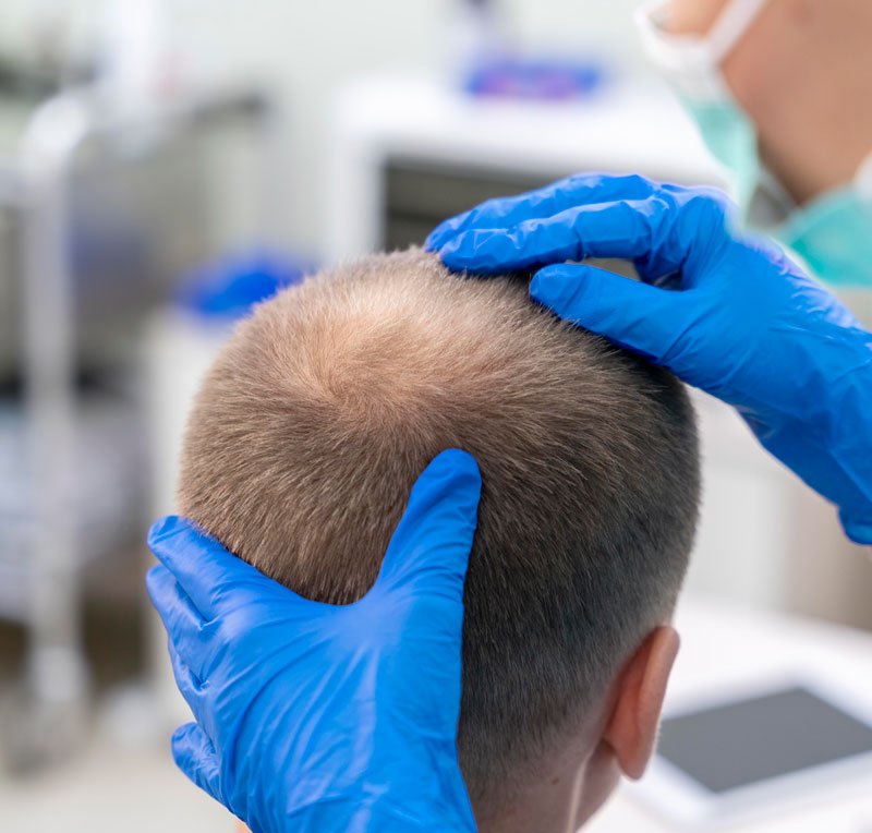 Imagen de tratamiento capilar